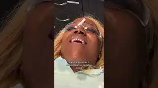Achieving the Perfect Smile with Veneers