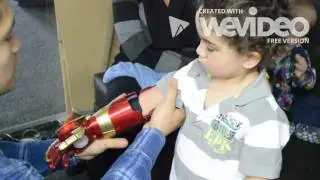 Superhero prosthesis