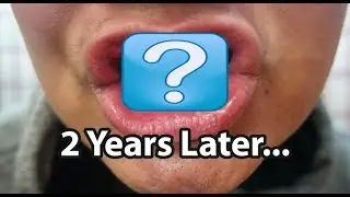 Teeth Whitening Strips Last for a REALLY REALLY LONG TIME
