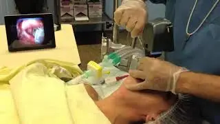 Airtraq Guided Video Intubation - A360+iPad Gentle Intubation