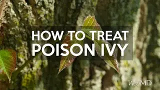 How to Treat Poison Ivy | WebMD