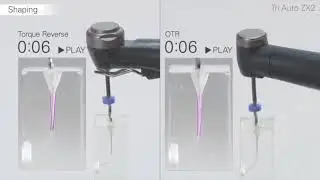 Movimento OTR, Endodonzia Automatica Intelligente