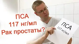 PSA 117 ng/ml – Prostate cancer? / Dr. Cherepanov