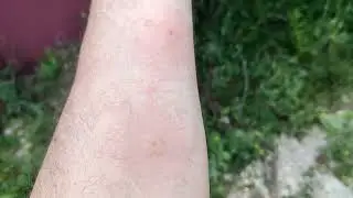 🐝 Жалит шершень / двойное ужаление