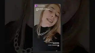Установка брекетов на нижнюю челюсть