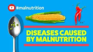 Diseases Caused by Malnutrition - SCURVY, RICKETS, BERIBERI, PELLAGRA