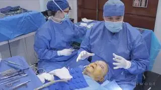 AccuTite ile Göz Kapağı ve Yüz Germe - AccuTite Bleph FaceLift WMarking