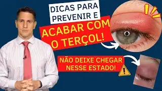 DICAS PARA SE LIVRAR DO TERÇOL! | Dr. Arthur Farache