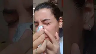 limpieza facial #skincare #face #limpieza #cutis #limpiezaextrema #limpiezafacial #cara #pielbella #