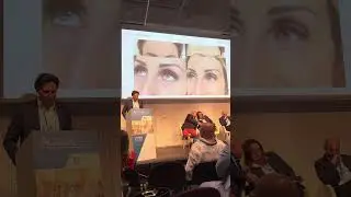 Complicanze da filler a base di acido ialuronico