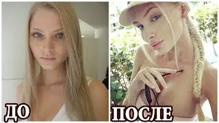 АЛЁНА ШИШКОВА - ФОТО ТОГДА И СЕЙЧАС. ФОТО ДО И ПОСЛЕ ПЛАСТИКИ