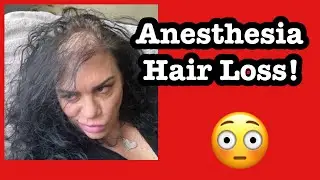 Anesthesia Hair Loss. Yes! It’s a thing!