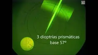 Lente astigmática descentrada
