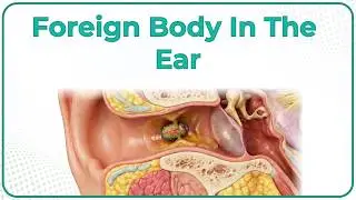 Foreign Body In The Ear 👂 : ENT Lectures