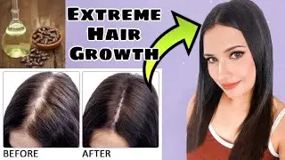 EXTREME HAIR GROWTH OIL in this Winter | Grow Your Hair Faster, Thicker & Longer
