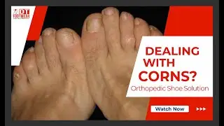 Foot Corn: Well Fitting Shoes For Corns on Feet