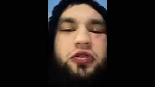 Влад Гантеля после драки с Лёшей Бицепсом
