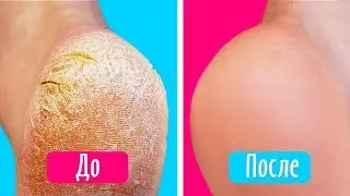 DIY PEEL OFF PEDICURE