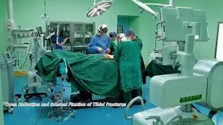 [Perlove Medical 2023] PLX7500 high end 3D carm clinical solution