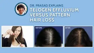 Differences Between Telogen Effluvium, and Genetic Pattern Hair Loss
