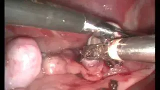 Sterilisatie (laparoscopic ovariectomy) jonge Border Terrier