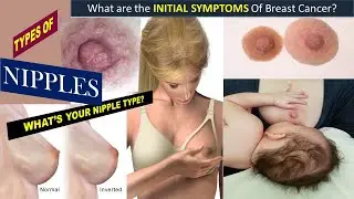 TYPES OF NIPPLES- What kind of nipples are normal?