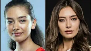 PLASTIK OPERATSIYA QILDIRGAN TURK AKTRISALARI!!! Турецкие актрисы до и после пластики