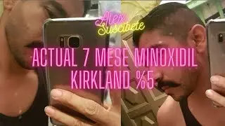 Actual 7 meses  MINOXIDIL KIRKLAND %5