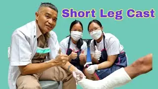 Learning by doing #:Short Leg Cast