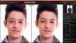 Portrait Professional Tutorial - Removing Acne - HD