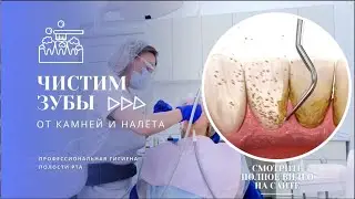 ЧИСТКА ЗУБОВ ПО САМОЙ ЛУЧШЕЙ ЦЕНЕ В ЕКАТЕРИНБУРГЕ