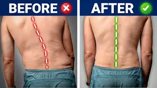 Fix Lateral Shift/Crooked Back FAST