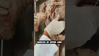 Muscles of upper limb  #17 | Anatomy Abdomen and Pelvis | #mbbs #neet #viral #shorts #shortfeed