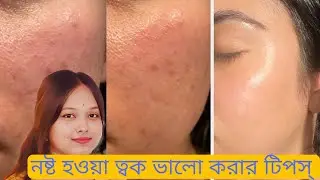 খারাপ হওয়া ও পাতলা হয়ে যাওয়া ত্বক কে আবার ভালো করার সহজ ও কার্যকর উপায় How to restore damaged skin?