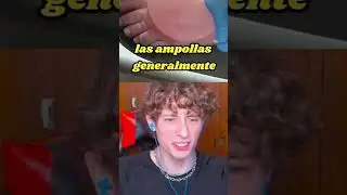 ES UNA AMPOLLA ENORMEE!!😱