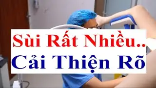 Kết Quả Sau 1 Lần Đốt Sùi Mào Gà Rất Nhiều Cho B.Nhân Nữ 30 Tuổi Tại Bs Sắc Việt Đức