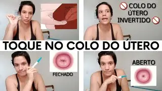#Recomendado