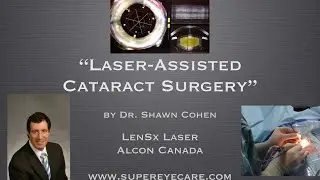 LenSx Laser Assisted Bladeless Cataract Surgery by Dr. Shawn Cohen