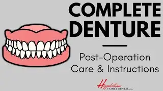 What To Do After Getting a Complete Denture | #experienceHFD