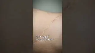 Висцеральный массаж, проработка внутренних органов #массаж #курсымассажа #massage #анатомия