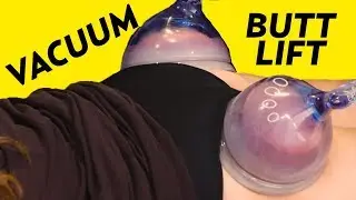 Vacuum Butt Lift? A Cellulite Treatment to Get a Big Booty! | The SASS with Susan and Sharzad
