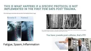 We Focus on Recovery: NOT Symptoms!