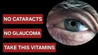 NO CATARACTS  NO GLAUCOMA  TAKE THIS VITAMINS