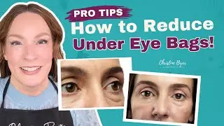 How to Reduce Under Eye Bags | Tips from an Esthetician