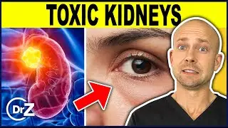 10 Warning Signs Your Kidneys Are Toxic