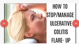 How to stop/manage ulcerative colitis flare-up
