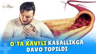 МЎЖИЗАНИ КЎРИНГ! УШБУ ГИЁХНИ ИЧДИМ ВА ҚОН БОСИМИМ ЙЎҚОЛДИ