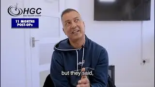 “I Look Years Younger” — Real Patient Shares His Hair Transplant Journey