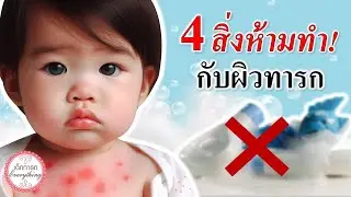 วิธีเลี้ยงเด็กทารก : 4 เรื่องห้ามทำกับผิวทารก! | ผิวเด็กทารก | เด็กทารก Everything