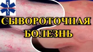 Сывороточная болезнь / Симптомы / Неотложная помощь